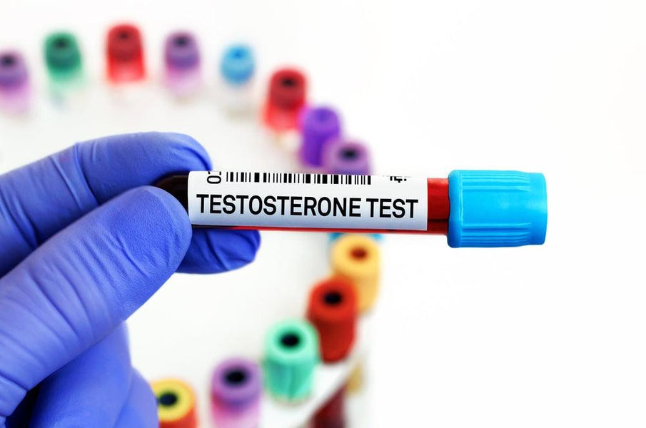 How to Test Testosterone Levels at Home in the UK