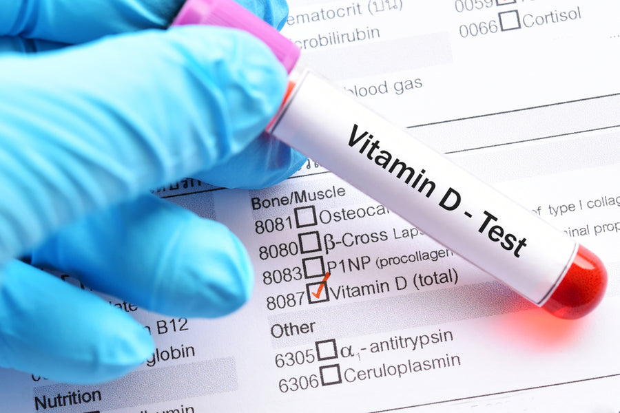 How Do I Check My Vitamin D Levels?