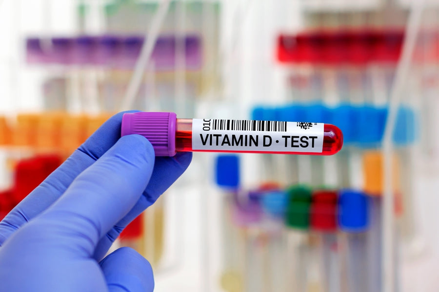 Is a Vitamin D Test Necessary?